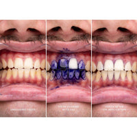 HiSmile V34 Teeth Whitening Colour Corrector Serum 30ml