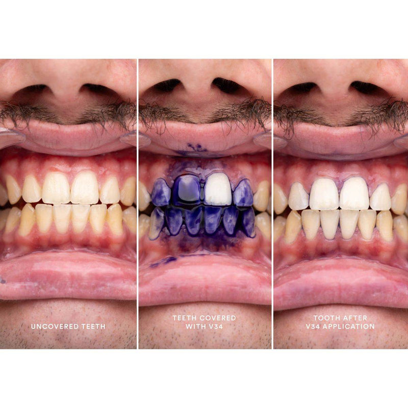 HiSmile V34 Teeth Whitening Colour Corrector Serum 30ml