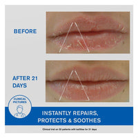 Uriage Bariederm Cica Lips Protective Balm 15ml