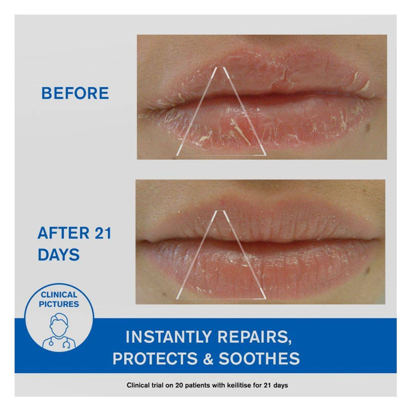 Uriage Bariederm Cica Lips Protective Balm 15ml