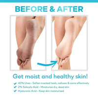 CeraVe SA Renewing Foot Cream 88ml