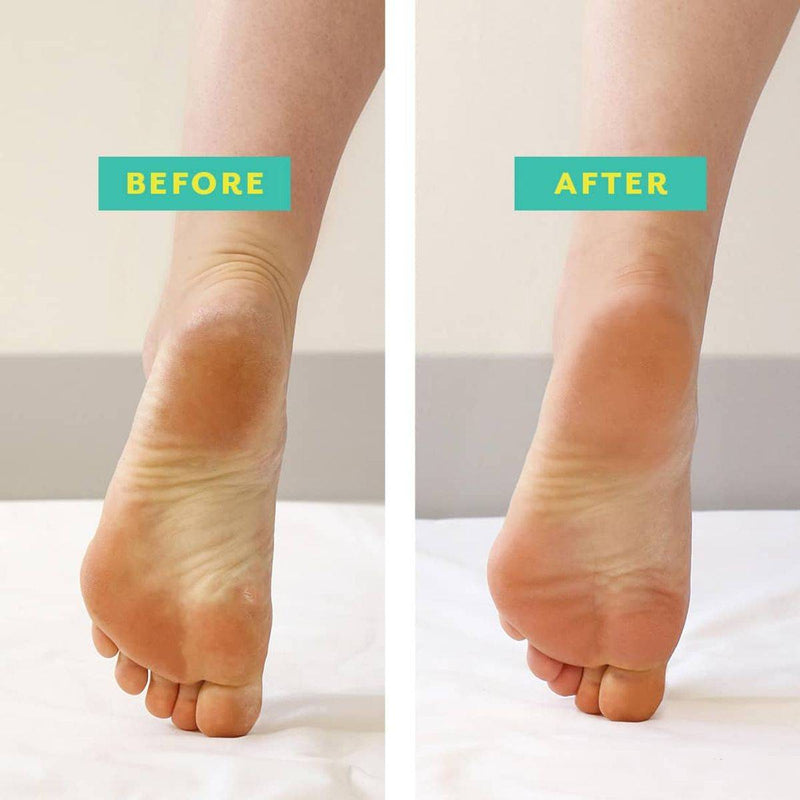 Patchology PoshPeel PediCure Foot Mask 1 Pair