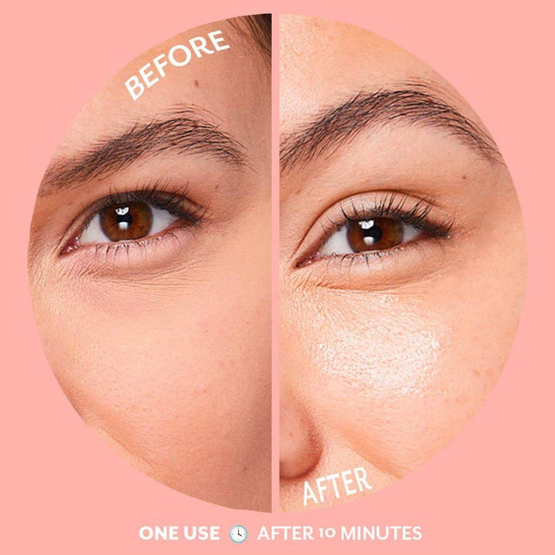 Patchology Serve Chilled Bubbly Eye Gels 15 Pairs