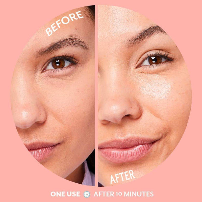 Patchology Hydrogel Bubbly Mask Sheet Mask 1 Pack