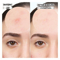 Garnier PureActive Invisible Pimple Patch 22 Pieces