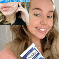 Panoxyl Acne Wash 4% Creamy 170g