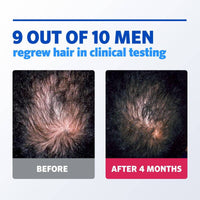 Regaine Men 5% Foam 60g/73ml Single Pack