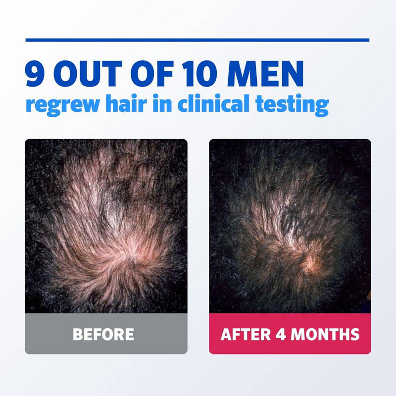 Regaine Men 5% Foam 60g/73ml Single Pack