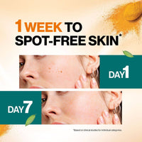 Himalaya Dark Spot Clearing Turmeric Scrub 75ml