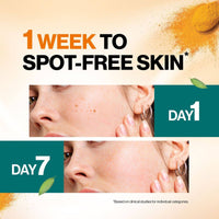 Himalaya Dark Spot Clearing Turmeric Cream 50G