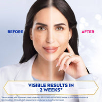 Nivea Face Luminous 630 Even Glow Serum 10ml