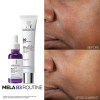La Roche Posay Mela B3 Serum 30ml