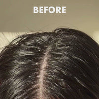 Umberto Giannini Rosemary Hair & Scalp Oil 50ml