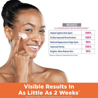 Palmers Skin Success Fade Cream for All Skin Types 75g