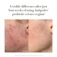 Antipodes Credo Probiotic Anti Blemish Serum 30ml