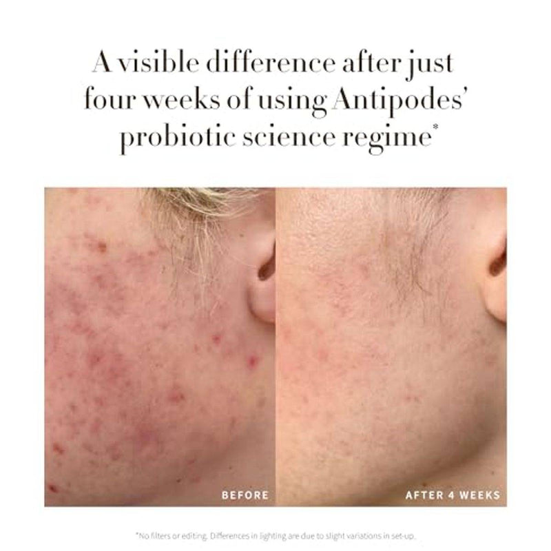 Antipodes Credo Probiotic Anti Blemish Serum 30ml