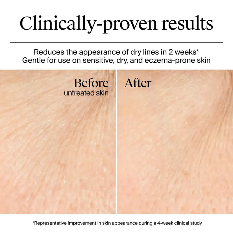 Neutrogena Hydro Boost Gel Cream Dry Skin 50ml