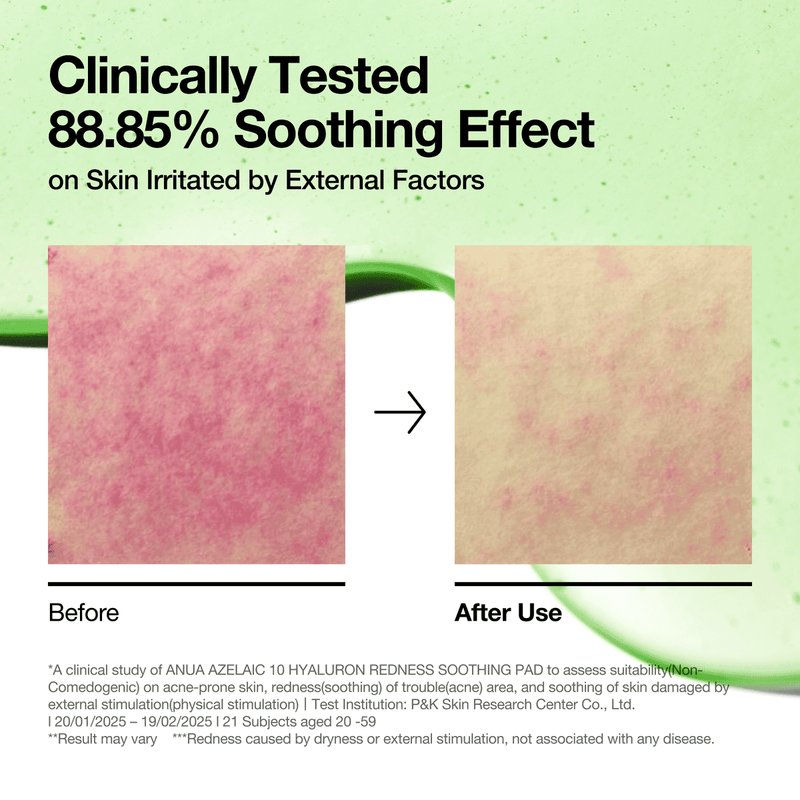 Anua Azelaic Acid 10+ Hyaluron Redness Soothing 90 Pieces