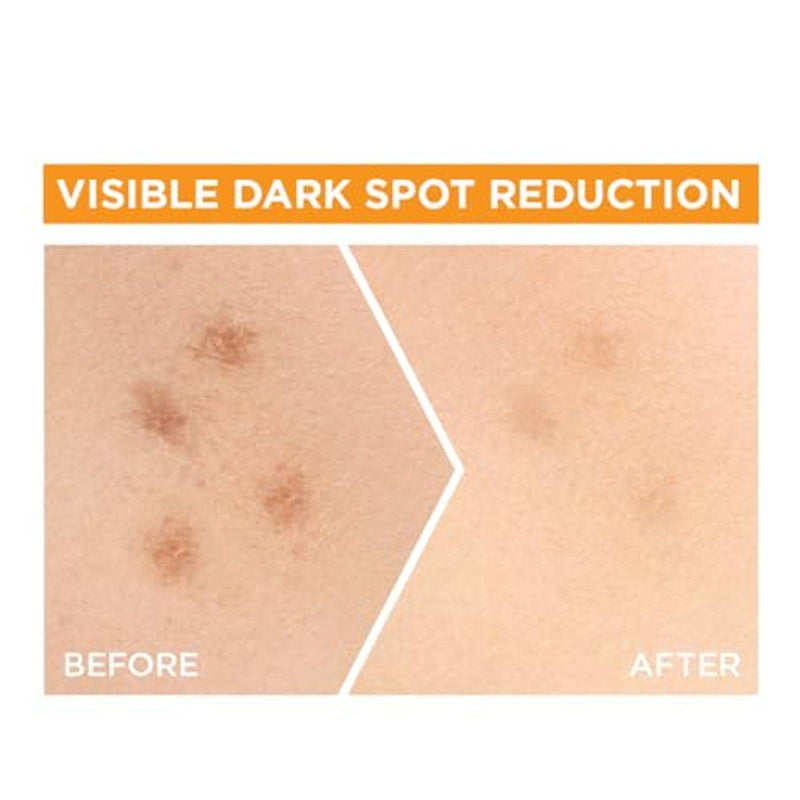 Garnier SkinActive Fast Bright Vitamin C Face Serum 50ml