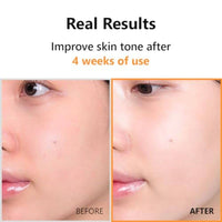Isntree Hyper Vitamin C 23 Serum 20ml
