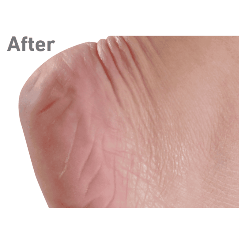 O'Keeffe's Healthy Feet Cream 76g