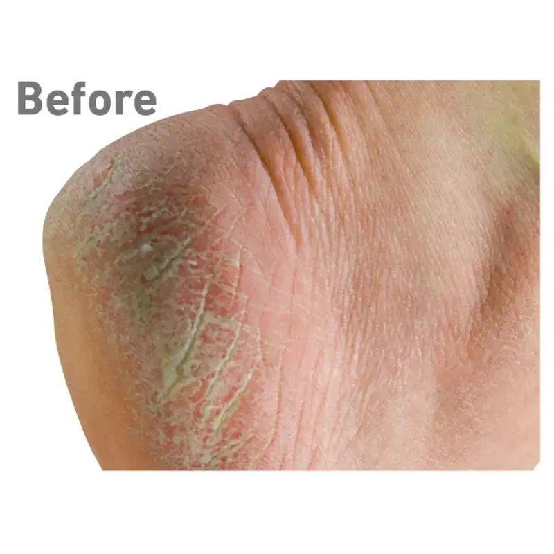 O'Keeffe's Healthy Feet Cream 76g