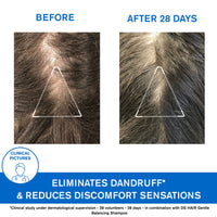Uriage DS Hair Shampoo Anti Dandruff 200ml