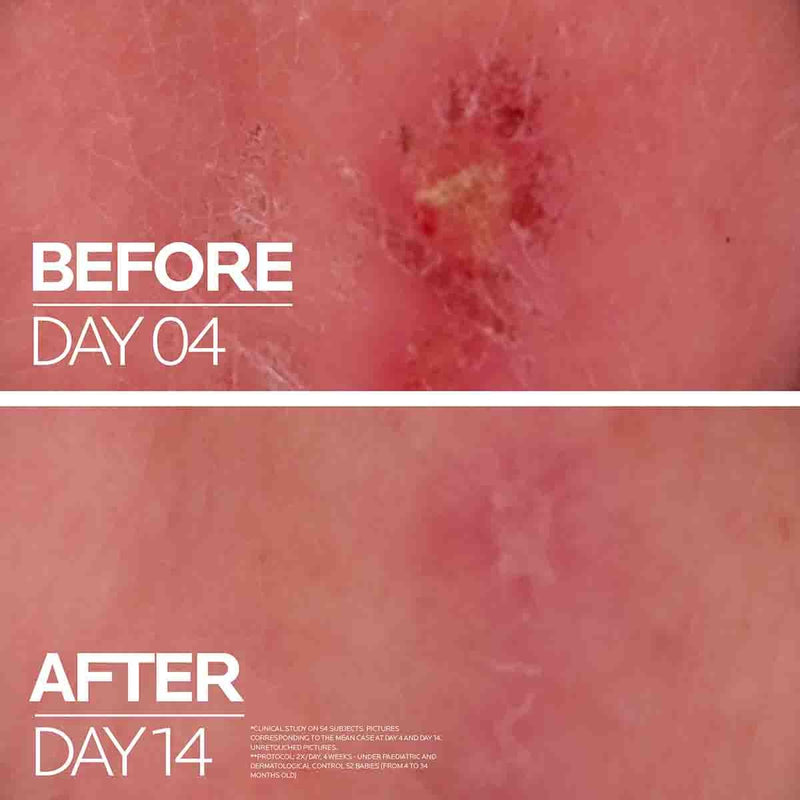 La Roche Posay Cicaplast Baume B5+ 40ml